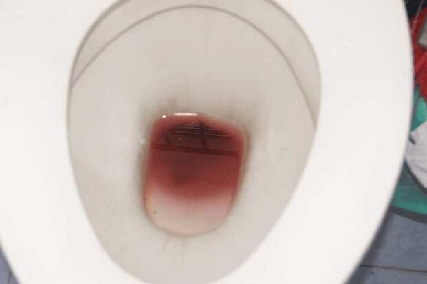 зацапване при мъжете, когато са развълнувани